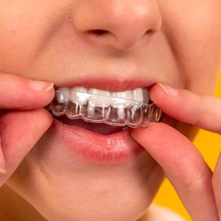 img-treatmentoption-suresmile