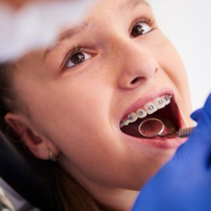 dental-braces-chelsea