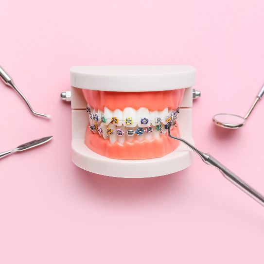 different types of braces